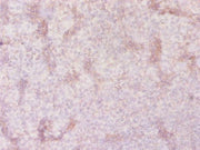Immunohistochemistry of paraffin-embedded human tonsil tissue using CSB-PA021643LA01HU at dilution of 1:20