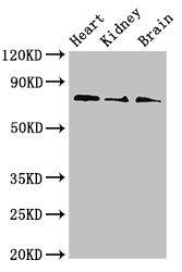 Western Blot Positive WB detected in: Mouse heart tissue, Mouse kidney tissue, Mouse brain tissue All lanes: SLC5A1 antibody at 4ug/ml Secondary Goat polyclonal to rabbit IgG at 1/50000 dilution Predicted band size: 74, 61 kDa Observed band size:...