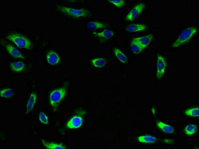 Immunofluorescent analysis of Hela cells using CSB-PA021676LA01HU at dilution of 1:100 and Alexa Fluor 488-congugated AffiniPure Goat Anti-Rabbit IgG(H+L)