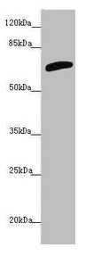 Western blot All lanes: SLC6A12 antibody at 4.47µg/ml + PC-3 whole cell lysate Secondary Goat polyclonal to rabbit IgG at 1/10000 dilution Predicted band size: 70 kDa Observed band size: 70 kDa