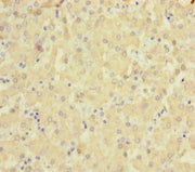 Immunohistochemistry of paraffin-embedded human liver tissue using CSB-PA021690ESR2HU at dilution of 1:100