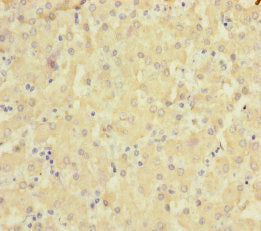 Immunohistochemistry of paraffin-embedded human liver tissue using CSB-PA021690ESR2HU at dilution of 1:100