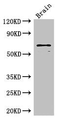 Western Blot Positive WB detected in: Mouse brain tissue All lanes: SLC6A3 antibody at 3ug/ml Secondary Goat polyclonal to rabbit IgG at 1/50000 dilution Predicted band size: 69 kDa Observed band size: 69 kDa