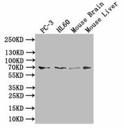 Western Blot Positive WB detected in: PC-3 whole cell lysate, HL60 whole cell lysate, Mouse Brain tissue lysate, Mouse Liver tissue lysate All lanes: SLC6A6 antibody at 1:1000 Secondary Goat polyclonal to rabbit IgG at 1/50000 dilution Predicted b...