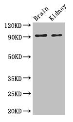 Western Blot Positive WB detected in: Mouse brain tissue, Mouse kidney tissue All lanes: SLC9A1 antibody at 3ug/ml Secondary Goat polyclonal to rabbit IgG at 1/50000 dilution Predicted band size: 91, 62 kDa Observed band size: 91 kDa
