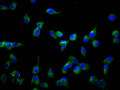 Immunofluorescence staining of SH-SY5Y cells with CSB-PA021741LA01HU at 1:166, counter-stained with DAPI. The cells were fixed in 4% formaldehyde, permeabilized using 0.2% Triton X-100 and blocked in 10% normal Goat Serum. The cells were then incu...