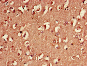 Immunohistochemistry of paraffin-embedded human brain tissue using CSB-PA02174D0Rb at dilution of 1:100