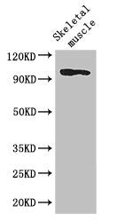 Western Blot Positive WB detected in: Mouse skeletal muscle tissue All lanes: SLFN11 antibody at 2.8ug/ml Secondary Goat polyclonal to rabbit IgG at 1/50000 dilution Predicted band size: 103 kDa Observed band size: 103 kDa