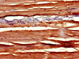 Immunohistochemistry of paraffin-embedded human skeletal muscle tissue using CSB-PA021769LA01HU at dilution of 1:100