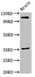 Western Blot Positive WB detected in: Mouse brain tissue All lanes: SLITRK5 antibody at 2ug/ml Secondary Goat polyclonal to rabbit IgG at 1/50000 dilution Predicted band size: 108, 80 kDa Observed band size: 108 kDa