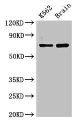 Western Blot Positive WB detected in: K562 whole cell lysate, Mouse brain tissue All lanes: SLU7 antibody at 3ug/ml Secondary Goat polyclonal to rabbit IgG at 1/50000 dilution Predicted band size: 69 kDa Observed band size: 69 kDa