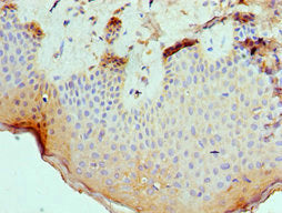 Immunohistochemistry of paraffin-embedded human skin tissue using CSB-PA021784ESR2HU at dilution of 1:100