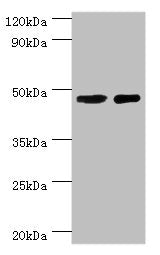 Western blot All lanes: SMAD3 antibody at 8ug/ml Lane 1: Jurkat whole cell lysate Lane 2: A431 whole cell lysate Secondary Goat polyclonal to rabbit IgG at 1/10000 dilution Predicted band size: 49, 44, 36, 26 kDa Observed band size: 49 kDa