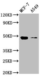 Western Blot Positive WB detected in: MCF-7 whole cell lysate, A549 whole cell lysate All lanes: SMAD3 antibody at 4µg/ml Secondary Goat polyclonal to rabbit IgG at 1/50000 dilution Predicted band size: 49, 44, 36, 26 kDa Observed band size: 49 kDa