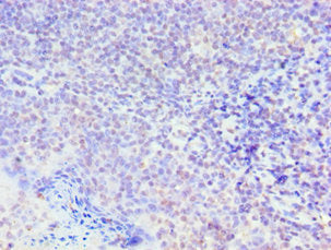 Immunohistochemistry of paraffin-embedded human tonsil tissue using CSB-PA021794ESR1HU at dilution of 1:100