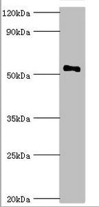 Western blot All lanes: Mothers against decapentaplegic homolog 9 antibody at 2ug/ml + 293T whole cell lysate Secondary Goat polyclonal to rabbit IgG at 1/10000 dilution Predicted band size: 53, 49 kDa Observed band size: 53 kDa