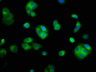 Immunofluorescence staining of HepG2 cells with CSB-PA021814LA01HU at 1:100, counter-stained with DAPI. The cells were fixed in 4% formaldehyde, permeabilized using 0.2% Triton X-100 and blocked in 10% normal Goat Serum. The cells were then incuba...