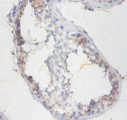 Immunohistochemistry of paraffin-embedded human testis tissue using CSB-PA021820DA01HU at dilution of 1:100