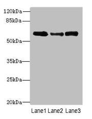 Western blot All lanes: Smox antibody at 3µg/ml Lane 1: PC-3 whole cell lysate Lane 2: A549 whole cell lysate Lane 3: 293T whole cell lysate Secondary Goat polyclonal to rabbit IgG at 1/10000 dilution Predicted band size: 62, 66, 27, 23, 28, 60, 5...