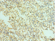 Immunohistochemistry of paraffin-embedded human spleen tissue using CSB-PA021873ESR2HU at dilution of 1:100