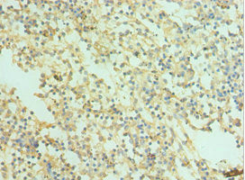 Immunohistochemistry of paraffin-embedded human spleen tissue using CSB-PA021873ESR2HU at dilution of 1:100