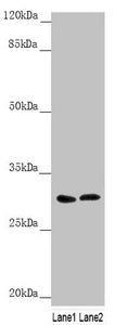 Western blot All lanes: SNAP29 antibody at 1.79µg/ml Lane 1: 293T whole cell lysate Lane 2: Jurkat whole cell lysate Secondary Goat polyclonal to rabbit IgG at 1/10000 dilution Predicted band size: 29 kDa Observed band size: 29 kDa