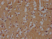 IHC image of CSB-PA021912OA01HU diluted at 1:100 and staining in paraffin-embedded human brain tissue performed on a Leica BondTM system. After dewaxing and hydration, antigen retrieval was mediated by high pressure in a citrate buffer (pH 6.0). S...
