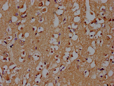 IHC image of CSB-PA021912OA01HU diluted at 1:100 and staining in paraffin-embedded human brain tissue performed on a Leica BondTM system. After dewaxing and hydration, antigen retrieval was mediated by high pressure in a citrate buffer (pH 6.0). S...