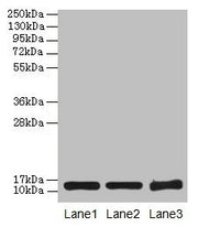 Western blot All lanes: SNCG antibody at 16µg/ml Lane 1: HT29 whole cell lysate Lane 2: Mouse brain tissue Lane 3: 293T whole cell lysate Secondary Goat polyclonal to rabbit IgG at 1/10000 dilution Predicted band size: 14 kDa Observed band size: 1...