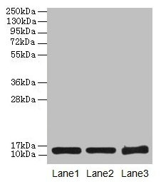 Western blot All lanes: SNCG antibody at 16µg/ml Lane 1: HT29 whole cell lysate Lane 2: Mouse brain tissue Lane 3: 293T whole cell lysate Secondary Goat polyclonal to rabbit IgG at 1/10000 dilution Predicted band size: 14 kDa Observed band size: 1...