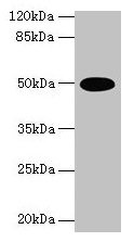 Western blot All lanes: TUFM antibody at 2µg/ml + U251 whole cell lysate Secondary Goat polyclonal to rabbit IgG at 1/10000 dilution Predicted band size: 50 kDa Observed band size: 50 kDa
