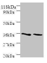 Western blot All lanes: SNX20 antibody at 2µg/ml Lane 1: Mouse spleen tissue Lane 2: Mouse skeletal muscle tissue Secondary Goat polyclonal to rabbit IgG at 1/10000 dilution Predicted band size: 37, 18, 15, 12 kDa Observed band size: 37 kDa