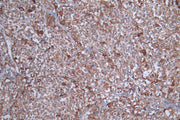 IHC image of CSB-PA022385DSR1HU diluted at 1:100 and staining in paraffin-embedded human adrenal gland tissueperformed on a Leica BondTM system. After dewaxing and hydration, antigen retrieval was mediated by high pressure in a citrate buffer (pH...