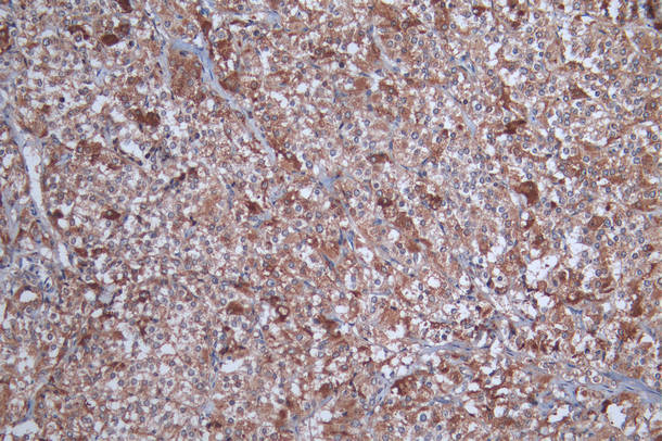 IHC image of CSB-PA022385DSR1HU diluted at 1:100 and staining in paraffin-embedded human adrenal gland tissueperformed on a Leica BondTM system. After dewaxing and hydration, antigen retrieval was mediated by high pressure in a citrate buffer (pH...