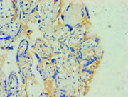 Immunohistochemistry of paraffin-embedded human prostate tissue using CSB-PA022385DSR2HU at dilution of 1:100