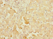 Immunohistochemistry of paraffin-embedded human liver tissue using CSB-PA022386ESR1HU at dilution of 1:100