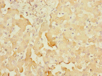 Immunohistochemistry of paraffin-embedded human liver tissue using CSB-PA022386ESR1HU at dilution of 1:100