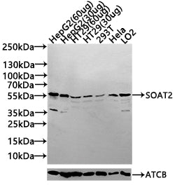 Western Blot Positive WB detected in: HepG2 whole cell lysate(60µg), HepG2 whole cell lysate(30µg), HT29 whole cell lysate(60µg), HT29 whole cell lysate(30µg), 293T whole cell lysate(30µg), Hela whole cell lysate(30µg),LO2 whole cell lysate(30µg)...