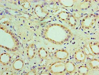 Immunohistochemistry of paraffin-embedded human kidney tissue using CSB-PA022388LA01HU at dilution of 1:100