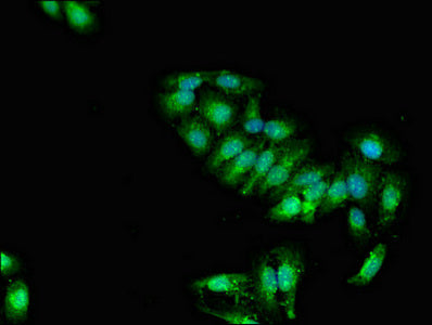 Immunofluorescent analysis of HepG2 cells using CSB-PA022389EA01HU at dilution of 1:100 and Alexa Fluor 488-congugated AffiniPure Goat Anti-Rabbit IgG(H+L)