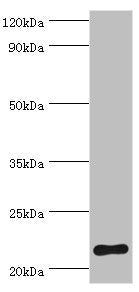 Western blot All lanes: Suppressor of cytokine signaling 2 antibody at 2ug/ml + HepG2 whole cell lysate Secondary Goat polyclonal to rabbit IgG at 1/10000 dilution Predicted band size: 22 kDa Observed band size: 22 kDa