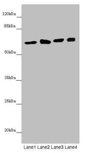 Western blot All lanes: SOCS4 antibody at 4.39 ug/ml Lane 1: Mouse kidney tissue Lane 2: Jurkat whole cell lysate Lane 3: A549 whole cell lysate Lane 4: 293T whole cell lysate Secondary Goat polyclonal to rabbit IgG at 1/10000 dilution Predicted b...