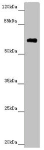Western blot All lanes: SOCS4 antibody at 4.25 ug/ml + Mouse kidney tissue Secondary Goat polyclonal to rabbit IgG at 1/10000 dilution Predicted band size: 60 kDa Observed band size: 60 kDa