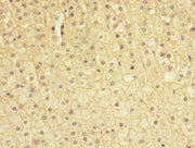 Immunohistochemistry of paraffin-embedded human adrenal gland tissue using CSB-PA022394ESR1HU at dilution of 1:100