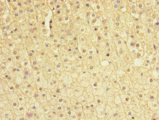 Immunohistochemistry of paraffin-embedded human adrenal gland tissue using CSB-PA022394ESR1HU at dilution of 1:100