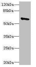 Western blot All lanes: SOCS5 antibody IgG at 1.83ug/ml + 293T whole cell lysate Secondary Goat polyclonal to rabbit IgG at 1/10000 dilution Predicted band size: 61 kDa Observed band size: 61 kDa