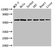 Western Blot Positive WB detected in: MCF-7 whole cell lysate, Hela whole cell lysate, Jurkat whole cell lysate, U87 whole cell lysate, Rat heart tissue, Rat liver tissue All lanes: SOCS7 antibody at 3µg/ml Secondary Goat polyclonal to rabbit IgG...