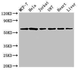 Western Blot Positive WB detected in: MCF-7 whole cell lysate, Hela whole cell lysate, Jurkat whole cell lysate, U87 whole cell lysate, Rat heart tissue, Rat liver tissue All lanes: SOCS7 antibody at 3µg/ml Secondary Goat polyclonal to rabbit IgG...