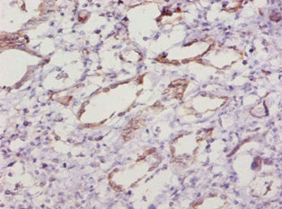 Immunohistochemistry of paraffin-embedded human kidney tissue using CSB-PA022397LA01MO at dilution of 1:10