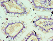 Immunohistochemistry of paraffin-embedded human small intestine tissue using CSB-PA022399ESR1HU at dilution of 1:100